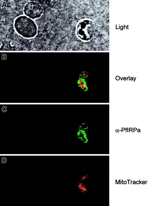 Fig. 5. Visualization of PfIRPa via indirect immunofluorescence probing. / The suspension of infected erythrocytes was first loaded with 50 nmoles MitoTracker for 30 minutes. The suspension was washed and fixed with 4% paraformaldehyde, 0.05% glutaraldehyde. The cells were allowed to adhere and to dry to poly-L-lysine–coated microscopic slides. The slides were washed in PBS-Tween (0.01%) and PBS. Nonspecific epitopes of cells were quenched with 5% BSA in PBS, washed, and probed with a primary antibody (rabbit polyclonal 3950) followed by a secondary antibody (goat antirabbit, alexa488). The slides were washed and mounted in the presence of VectaShield liquid, before taking fluorescence images. The images were taken at the excitation wavelengths of 488 nm for alexa488 and at the 680 nm for MitoTracker.