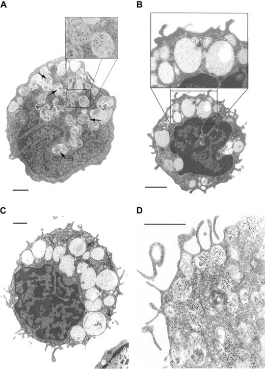 Fig. 1. Tryptase immunoelectron microscopy. / (A) Blood basophil from a patient with chronic phase CML. Tryptase-immunoreactive material is localized to a subset of granules (arrows; original magnification × 5000; inset, × 10 000). (B) Basophil of a healthy donor shows no tryptase expression by immunoelectron microscopy (original magnification × 6500; inset × 13 000). (C) Tryptase immunoelectron microscopy of a CB culture–derived basophil (IL-3, day 13); no significant amounts of tryptase could be detected (original magnification × 4000). (D) Tryptase immunoelectron microscopy of a CB culture–derived MC (SCF, day 28). In this cell tryptase-reactive material could be detected. Note surface projections and granular staining pattern (original magnification × 12 500). 1 bar = 1 μm.