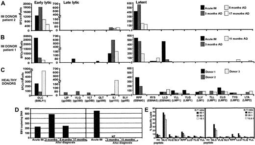 Fig. 1. Analysis of the EBV-specific CTL response and EBV DNA load in the peripheral blood of IM patients. / (A-C) Functional analysis of EBV-specific CTL responses in acute IM patients 2 (A) and 1 (B), and 3 healthy donors (C) using ELISPOT assay. PBMCs from these individuals were stimulated with peptide epitopes from early lytic, late lytic, and latent antigens, and the interferon γ response was measured in ELISPOT assays as described previously.4 The following CTL epitopes were used in this study: restricted through HLA A2—GLCTLVAML (GLC), SLVIVTTFV (SLV), ILIYNGWYA (ILI), VLQWASLAV (VLQ), VLTLLLLLV (VLT), LIPETVPYI (LIP), QLTPHTKAV (QLT), LLDFVRFMGV (LLD), YLQQNWWTL (YLQ), YLLEMLWRL (YLL), LLVDLLWLL (LLV), TLLVDLLWL (TLL), LTAGFLIFL (LTA), CLGGLLTMV (CLG); HLA B7—RPPIFIRRL (RPP); and HLA A24—RYSIFFDY (RYS), TYGPVFMCL (TYG). For acute IM patients, ELISPOT analysis was conducted during the acute phase of infection and at different time intervals after diagnosis (AD). The results are expressed as spot-forming cells (SFCs) per 106 PBMCs. NT indicates not tested. (D) EBV DNA load in the peripheral blood of IM patients 2 (left) and 1 (right) at diagnosis and after diagnosis. EBV DNA load was measured as described elsewhere.5 (E) EBV epitope–specific ex vivo cytotoxic T-cell activity in peripheral blood lymphocytes from IM donors using peptide-sensitized (1 μg/mL) phytohemagglutinin blasts as targets. Peptide epitopes used in these assays are shown on the x-axis. Results are expressed as percent specific lysis. E/T ratio indicates effector-target ratio.