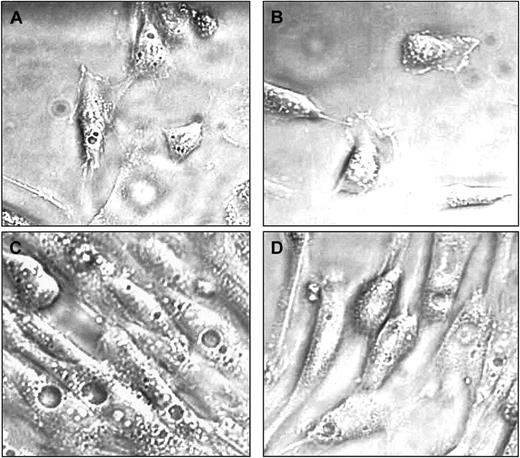 Fig. 1. Morphology of MPCs. / CD45−GlyA− cells were plated on FN in expansion medium with 2% FCS, 10 ng/mL EGF, and 10 ng/mL PDGF-BB and passaged for 15 cell doublings (A) and 53 cell doublings (B) to maintain a cell density between 2 and 8 × 103/cm2. Alternatively, MPCs were maintained for 15 cell doublings in MPC medium containing 10% FCS (C) or at a density greater than 104/cm2 (D). MPCs cultured at low density and with 2% or less FCS are small (10 to 15 μm diameter) and have scant cytoplasm with few vacuoles or granules. In contrast, MPCs cultured either with 10% FCS or at higher density are significantly larger (greater than 20 μm diameter) and often contain vacuoles or granules. Shown are phase-contrast pictures at 80 × magnification. A representative example of more than 5 experiments is shown.