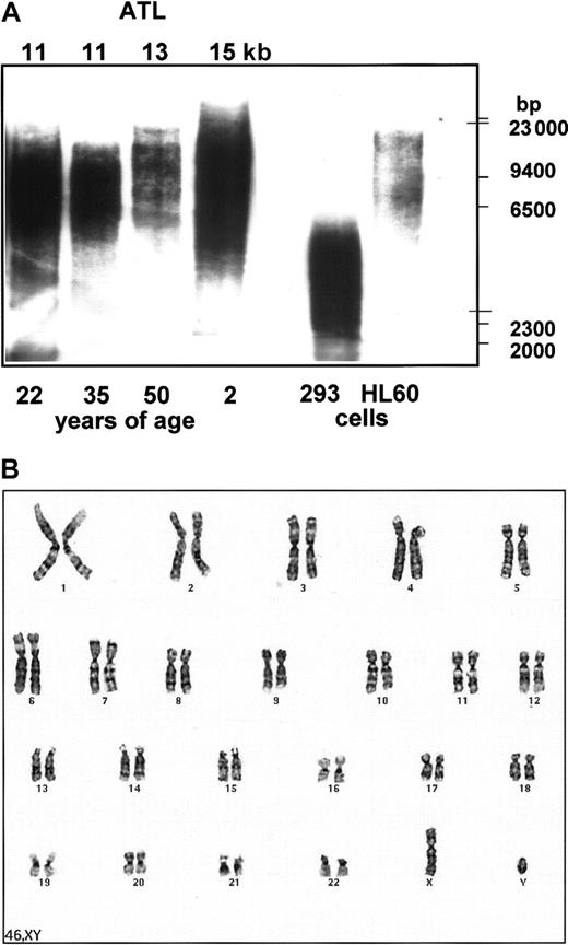 Fig. 3. Characteristics of culture-expanded MPCs. / Culture-expanded MPCs have long telomeres and are cytogenetically stable. (A) CD45−GlyA− cells from 4 donors ages 2 to 50 were plated on FN in expansion medium with 2% FCS, 10 ng/mL EGF, and 10 ng/mL PDGF-BB, and passaged for 35 cell doublings. Cells were harvested and telomere lengths evaluated. Lanes 1 = 22 years; lane 2 = 35 years; lane 3 = 50 years; lane 4 = 2 years; lane 5 = 293 cells; lane 6 = HL60 cells. ATL indicates average telomere length. (B) CD45−GlyA− cells were plated on FN in expansion medium with 2% FCS, 10 ng/mL EGF, and 10 ng/mL PDGF-BB and passaged for 40 cell doublings. Cells were harvested 24 hours after replating and were cytogenetically analyzed. A representative example of 4 experiments is shown.
