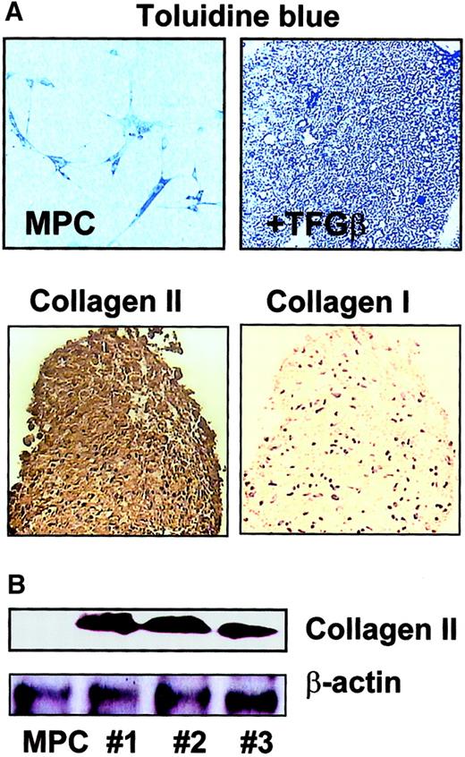 Fig. 6. Chondroblast differentiation from MPCs. / MPCs were trypsinized and cultured in expansion medium without serum, EGF, or PDGF-BB, but with 100 ng/mL TGF-β1 in micromass culture. For micromass cultures, 1 × 106 MPCs were diluted in 1 mL culture medium and added to a 15-mL conical tube, where close cell-cell interaction was induced. Differentiation to chondroblasts was shown by toluidine blue staining and positive staining for type II collagen but not type I collagen (A; enlargement = 10 ×). Presence of type II collagen was confirmed by Western blot on day 14 (B; clones nos. 1, 2, and 3; see also Figure 12; β-actin serves as loading control). A representative example of more than 5 experiments is shown.