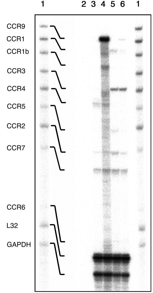 Fig. 2. Analysis of the chemokine receptor transcripts expressed in freshly isolated thymocytes. / Total RNA extracted from thymi and spleen from CCR9-deficient and wild-type mice were analyzed by multiprobe ribonuclease protection assay using a mCR-5 RiboQuant mouse template set (BD Pharmingen). The autoradiogram shows the mCR-5–probe set not treated with RNases (lane 1), and the RNase-protected bands following hybridization with control yeast tRNA (line 2) with RNA isolated from CCR9-deficient (lane 3), or wild-type thymi (lane 4). Also shown are the RNase-protected bands obtained after hybridization with RNA isolated from CCR9-deficient spleens (lane 5), or wild-type spleens (lane 6). The identity of the various protected bands is indicated on the left.