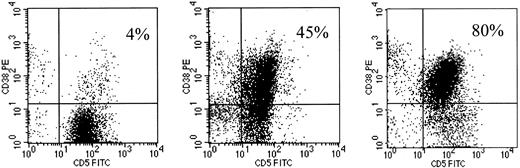 Fig. 1. Flow cytometric profiles of CD38 expression on 3 CD5+CD19+ B-CLL cases. / B-CLL cases were analyzed by flow cytometry after exposure to anti-CD19–APC, anti-CD5–FITC, and anti-CD38–PE. The events represented were obtained by gating on cells expressing CD19. The variable percentages of CD5+CD38+ cells are reported on the upper-right quadrant region of each dot-plot.
