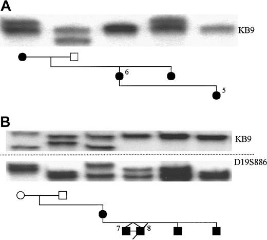 Fig. 2. Linkage analysis in the autosomal dominant families without ELA2 mutations. / In family A, which includes patients 5 and 6, the KB9 marker is shown not to segregate with the disease phenotype. In family B, which includes patients 7 and 8, linkage cannot be excluded by the use of the markers KB9 (upper) and D19S886 (lower).