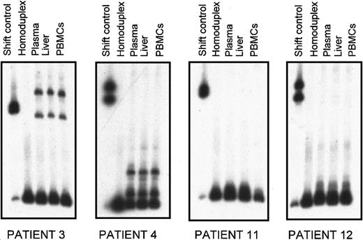Fig. 3. Heteroduplex tracking assay of HVR1 quasi species from plasma, liver, and PBMC2s from 4 patients with MC2 (patients 3, 4, 11, 12). / For each patient, heterogeneous HVR1 amplification products from different tissues were hybridized with 32P-labeled probe derived from plasma major variant. Lane 1 contains the heteroduplex shift control; lane 2 corresponds to the homoduplex control; lanes 3, 4, and 5 show quasi-species distribution in plasma, liver, and PBMC2s, respectively.