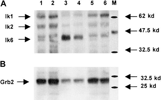 Fig. 2. Western blot analysis of wild-type and transduced cells. / Whole protein extracts obtained from CB CD34+ cells transduced with the LZRS-EGFP retroviral vector (lanes 1 and 2) or LZRS-Ik6-EGFP (lanes 3 and 4) and from untransduced CB CD34+ cells (lanes 5 and 6) are revealed with (A) an anti-Ikaros antiserum (see “Materials and methods”) or (B) an anti-Grb2 polyclonal antibody. M indicates protein markers. At least 3 isoforms of Ikaros (Ik1, Ik2, Ik6) are endogeneously produced; lanes 3 and 4 show that after retroviral transduction the relative abundance of the Ik6 isoform is greatly increased (note that for these 2 lanes the signal for Grb2 is slightly less than for other lanes).