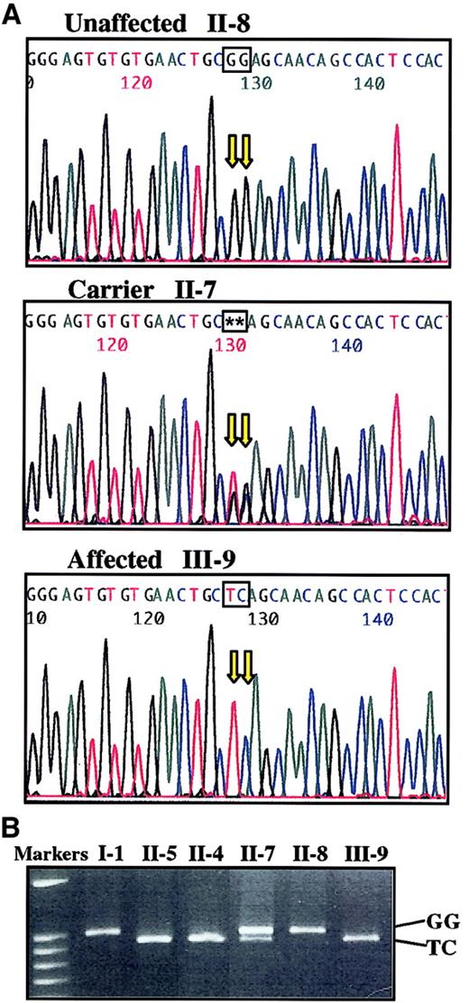 Fig. 4. Two-base mutation in. / GATA-1 segregates with thrombocytopenia. (A) cDNAs derived from an unaffected male (II-8, father), carrier female (II-7, mother), and affected male (III-9, son) were amplified withGATA-1 oligonucleotides (primer pair 2) and sequenced. The 2 bases mutated in this family (GG to TC) are highlighted in each sequence. (B) Genomic DNA samples from family members were amplified with GATA-1 primer pair 2 then digested with Cel-II endonuclease (recognition site, GCTNAGC). The larger band represents the wild-type allele (I-1, II-8), whereas mutant alleles contain a new Cel-II restriction site resulting in a 65-bp reduction of the largest DNA fragment (II-5, II-4, III-9). The presence of 2 bands (II-7) indicates carrier status with both alleles.