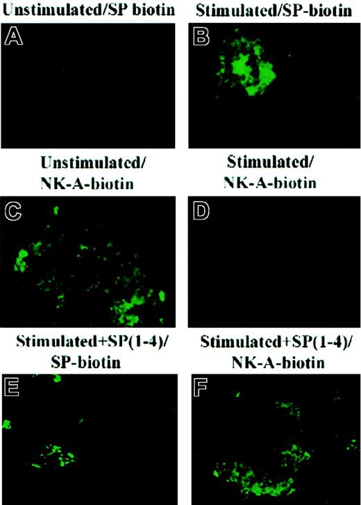 Fig. 2. Immunofluorescence for SP- and NK-A–binding sites in BM stroma. / Cells were stimulated with 10 ng/mL SCF and/or 10 nM SP(1-4) for 24 hours. After this, cells were labeled with biotin-SP or biotin–NK-A and then developed with FITC-avidin. Unstimulated (A,C); SCF-stimulated (B,D) consecutive stimulation with SCF and SP(1-4) (E-F).