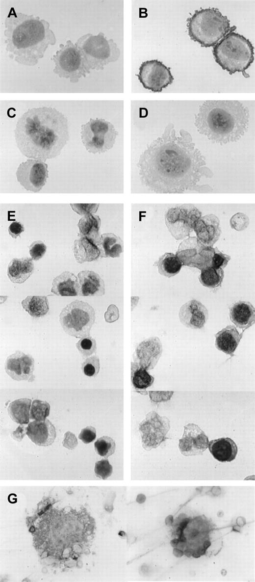 Fig. 2. Immunohistochemical staining for TfR2. / Cells were incubated with either 50-fold diluted normal rabbit serum (panels A and E) or 50-fold diluted rabbit anti-TfR2 antiserum (panels B-D, F-G) followed by immunohistochemical staining. Magnifications: panels A-F, × 1000; panel G, × 300. (A-B) TfR2-α stably transfected CHO-TRVb cells. (C) Neomycin-resistant control CHO-TRVb cells. (D) TfR1 stably transfected CHO-TRVb cells. (E-F) Normal human BM cells. (G) Representatives of TfR2-positive megakaryocytes.