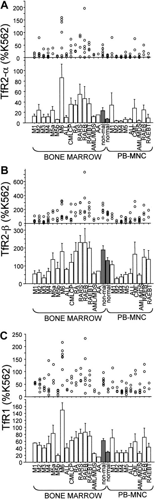 Fig. 4. Semiquantitative RT-PCR for expression ofTfR2-α, TfR2-β, and TfR1 mRNAs. / Expression levels of TfR2-α, TfR2-β, and TfR1mRNA are shown in panels A, B, and C, respectively. Each value was calculated as a percentage of the level detected in K562 cells (% K562). In every panel, each circle represents one sample, and every bar shows a mean ± SD in its clinical category. Nonmalignant BMs and normal PBMNCs were used as controls, and the bars corresponding to them were shaded. AML/MDS indicates AML evolved from MDS.