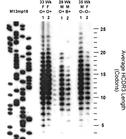 Fig. 2. The distribution of HCDR3 lengths in VDJCμtranscripts derived from the cord blood of 3 sets of twins of 33, 29, and 35 weeks' gestation. / Shown is an autoradiograph of 32P-labeled RT-PCR products that have been separated on the basis of length by denaturing polyacrylamide gel electrophoresis. M13mp18 sequence is used as a standard to determine the length of each fragment. Each set of twins is identified by age, sex, and blood type.