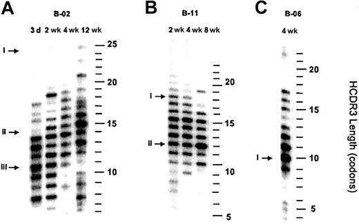 Fig. 4. Changes in the distribution of HCDR3 lengths in VDJCμ transcripts derived from the peripheral blood of 3 infants with positive blood cultures for bacteria. / Shown is an autoradiograph of 32P-labeled RT-PCR products that have been separated on the basis of length by denaturing polyacrylamide gel electrophoresis. The length of each HCDR3 fragment is identified on the right. (A) A premature infant who exhibited an increase in the range and mean of HCDR3 lengths over a 12-week period (see also Table 1, Figure 3). The arrows identify populations of VDJCμ transcripts of a specific length whose representation changed over time. (B) A premature infant who exhibited a decrease in the range and mean of HCDR3 lengths over an 8-week period. The arrows identify populations of VDJCμtranscripts of a specific length whose representation changed over time. (C) An infected premature infant whose mean HCDR3 length was near the lower limits of normal for age. The arrow identifies a population of VDJCμ transcripts of a relatively short length whose representation has contributed to the decreased mean in HCDR3 length distribution, when compared with other healthy premature infants of the same age.