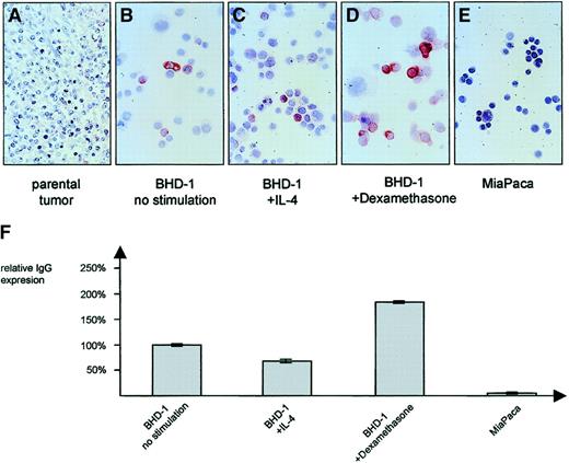 Fig. 5. IgG protein expression of MedB-1 cells. / In comparison with the IgG− parental tumor (A), a small subset of MedB-1 cells showed an expression of IgG protein, detectable by immunocytochemistry (B) and ELISA (F). Incubation for 48 hours in the presence of 100 U/mL IL-4 resulted in a down-regulation of IgG (C, F) whereas 10 μg/mL dexamethasone induced a moderate increase (D, F). ELISA data are given as mean value (no. = 5) and SD. Panel E shows negative control pancreatic carcinoma cell line MiaPaca. Original magnification ×50 (A), and ×100 (B-E).