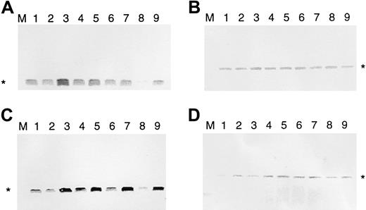 Fig. 1. IL-7 and IL-15 increase Bcl-2 protein levels in interleukin-starved SeAx cells. / (A) Regulation of bcl-2 expression by IL-7 (10 U). (B) Influence of IL-7 on β-actin expression (negative control). (C) Regulation of bcl-2 expression by IL-15. (D) Influence of IL-15 on β-actin expression (negative control). M, marker. Lane 1, 48-hour interleukin-starved SeAx cells. Lane 2, 54-hour interleukin-starved SeAx cells. Lane 3, 54-hour interleukin-starved SeAx cells after the 6-hour addition of IL-7 or IL-15. Lane 4, 60-hour interleukin-starved SeAx cells. Lane 5, 60-hour interleukin-starved SeAx cells after the 6-hour addition of IL-7 or IL-15. Lane 6, 72-h interleukin-starved SeAx cells. Lane 7, 72-hour interleukin-starved SeAx cells after the 6-hour addition of IL-7 or IL-15. Lane 8, 96-hour interleukin-starved SeAx cells. Lane 9, 96-hour interleukin-starved SeAx cells after the 6-hour addition of IL-7 or IL-15.