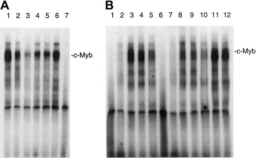 Fig. 2. Effect of IL-7 and IL-15 on the DNA-binding of c-Myb in SeAx cells. / (A) Nuclear extracts from different cell lines were incubated with a radioactively labeled oligonucleotide containing the c-mybbinding site of the bcl-2 promoter. Lanes 1 to 3, no interleukin added. Nuclear extracts from HUT78 (lane 1), MyLa 2059 (lane 2), and SeAx cells (lane 3). Lane 4, SeAx cells treated with 10 U IL-7. Lane 5, SeAx cells treated with 10 U IL-15. Lane 6, SeAx cells treated with 10 U IL-7 and IL-15. Lane 7, nuclear extract from PBLs of a healthy donor. (B) The binding of c-Myb to its target sequence is inhibited by a c-Myb antibody. Lanes 1 to 6, no antibody added. Lanes 6 to 10, c-Myb antibody added. Lanes 1 and 6, nuclear extract from PBLs. Lanes 2 and 7, nuclear extract from HeLa cells. Lanes 3 and 8, nuclear extract from HUT78 cells. Lanes 4 and 9, nuclear extract from MyLa 2059 cells. Lanes 5 and 10, nuclear extract from SeAx cells. Lanes 11 and 12, STAT5 antibody added as negative control. Lane 11, nuclear extract from HUT78 cells. Lane 12, nuclear extract from MyLa 2059.