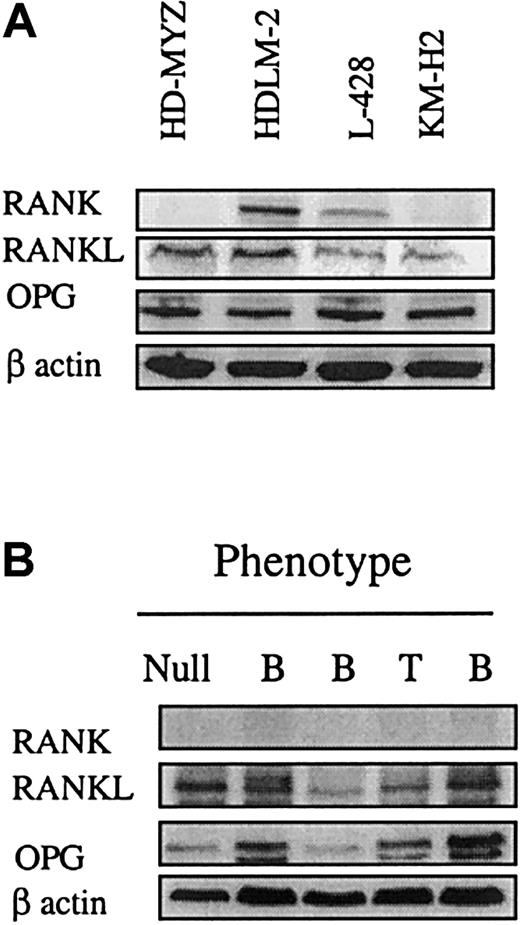 Fig. 1. Western blot analysis of RANK, OPG, and RANKL expression in cultured H/RS cells and primary lymphoid tumors. / (A) H/RS cell lines show that all cell lines expressed RANKL and OPG. RANK was predominantly expressed in HDLM-2 and L-428. The remaining 2 cell lines also expressed RANKL, but at very low levels. All cell lines expressed RANK and RANKL at the mRNA level (data not shown). (B) Primary lymphoid tumors of different phenotypes (B, T, or null) show that RANK was not expressed in these tumors, whereas all tumors expressed RANKL and OPG.