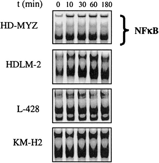Fig. 3. RANKL activates NF-κB in H/RS cell lines. / Incubation of these H/RS cell lines with RANKL (1 μg/mL) activated NF-κB, as shown by the EMSA method. NF-κB activation was most prominent in the HDLM-2 cell line. Activation was detected as early as 10 minutes after incubation with RANKL and lasted for up to 3 hours.