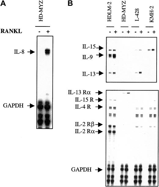 Fig. 5. RANKL induces the expression of several cytokines in H/RS cell lines. / Cell lines were incubated with RANKL (1 μg/mL) for 24 hours. Total RNA was extracted and subjected to RNase protection assay. (A) RANKL up-regulated IL-8 mRNA expression in the HD-MYZ cell line. (B) RANKL up-regulated the mRNA expression of IL-15, IL-9, IL-13, and IL-13 receptors in several cell lines. Table 1 shows the quantitative relative expression of cytokine mRNA by using the GAPDH signal as a control for the amount of input RNA.
