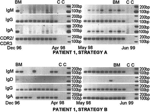 Fig. 2. Persistent expression of nonclinical and/or clinical isotypes at diagnosis and throughout the course of disease. / Nonclinical isotypes are detectable in a single-stage RT-PCR (strategy A). Patient 1 was followed from diagnosis in December 1996 to June 1999. She was treated with melphalan and prednisone from diagnosis until April 1998. She was on dexamethasone therapy from April 1998 until her death in November 1999 from MM-related BM failure and sepsis. Her treatment was only of modest clinical benefit. Her clinical isotype was IgG. The top panels show RT-PCR results using strategy A and the bottom panels show results using strategy B. This patient is representative of those having nonclinical clonotypic isotype expression sufficiently frequent to be detected in a single-stage PCR reaction. Some samples that were negative with strategy A, became positive when tested using nested PCR (strategy B). All samples were positive for expression of the patient-specific VDJ gene rearrangement (strategy D). BM indicates bone marrow samples; c, control lanes lacking cDNA.