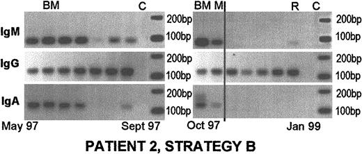 Fig. 3. Persistent pretransplantation nonclinical clonotypic isotypes in blood, BM, and autografts, followed by a loss of nonclinical isotypes after transplantation and re-emergence of clonotypic IgM at the time of relapse. / Patient 2 was diagnosed in May 1997. She provided PBMC samples until January 1999. Her treatment consisted of 3 cycles of chemotherapy, followed by high-dose melphalan with autologous blood stem cell support in January 1998. Her disease was clinically stable until she relapsed in January 1999. She was not a candidate for further treatment, and she died in July 2000. Her clinical isotype was IgG. The clinical isotype was always detectable using strategy A. Nonclinical isotypes were only detected using strategy B. All samples were positive for strategy D. Mobilized blood had detectable clinical and nonclinical clonotypic isotypes, and the clinical isotype persisted postautologous transplantation. All samples to the right of the vertical line were taken after transplantation. M, mobilized blood autografts; R, relapse. Other abbreviations are as for Figure 2.