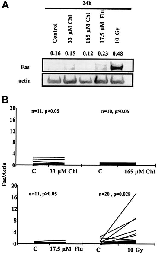 Fig. 3. Western blot analysis of B-CLL cells. / (A) Fas protein expression in a B-CLL sample after 24-hour incubation with Chl or Flu or after γ irradiation. Numbers above bands are the intensities of individual bands normalized with respect to actin band intensities in the same lane. (B) Fas Western blot data for multiple B-CLL samples normalized with respect to actin.