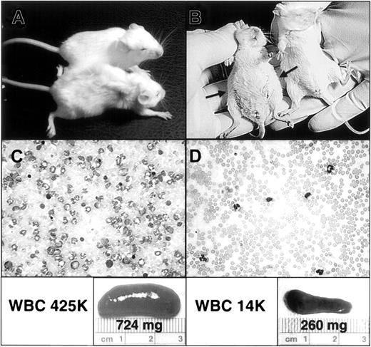 Fig. 1. Mice demonstrate clinical and hematopoietic response to STI571 treatment. / (A) An STI571-treated animal (top) is compared with placebo-treated animal (bottom) on day 21 after reconstitution with BM cells transduced with P210BCR/ABL retrovirus. Note the overall weakened appearance of the placebo-treated animal, including decreased skin turgor, reflecting volume depletion due to decreased oral intake in the setting of massive hepatosplenomegaly. In contrast, the STI571-treated animal demonstrates no clinical evidence of illness. (B) A ventral view of the same mice demonstrating the pronounced abdominal distention of the placebo-treated animal (left) secondary to marked hepatosplenomegaly (arrows), which is lacking in the STI571-treated mouse. (C-D) A representative blood smear and spleen from a placebo-treated (C) and STI571-treated (D) mouse, demonstrating the significant reduction in granulocytosis and splenomegaly obtained in STI571-responding animals. The respective white blood cell count (WBC) and spleen size and weight are also shown (lower panels). For the sake of comparison, the average WBC and spleen weight of control healthy mice (no. = 3) of the same strain and age are 8400/μL and 95.5 mg, respectively.