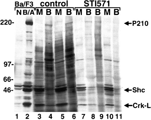 Fig. 4. STI571 alters the intensity of protein tyrosine phosphorylation in primary hematopoietic cells from mice with the CML-like illness. / Protein lysates from peripheral blood granulocytes (B) or BM (M) from the indicated placebo (control, lanes 3-6) and STI571-treated (lanes 7-11) mice were analyzed by antiphosphotyrosine immunoblot. A Ba/F3 cell line transduced with P210 (B/A) or retroviral vector alone (N) is shown at left as a control. The positions of P210BCR/ABL, Shc, and Crk-L are shown at far left.