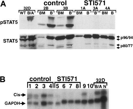 Fig. 5. STI571 inhibits constitutive STAT5 activation andcis gene expression in primary hematopoietic cells from animals with the CML-like illness. / (A) Protein lysates from either peripheral blood granulocytes (B) or whole BM cells obtained from placebo-treated (2B, 3B) or STI571-treated (1A, 3A, 4A) mice were analyzed by immunoblot with an antibody recognizing activated STAT5 (pSTAT5, upper panel), or an antibody against the amino-terminal region of STAT5, which recognizes both full-length STAT5A/B and carboxy-terminal isoforms of STAT5 (lower panel). As a control, lysates from wild-type (WT) or P210BCR/ABL–expressing (B/A) 32D cells are shown at left. The positions of full-length STAT5A and STAT5B (p96 and p94, respectively) and the truncated forms of each (p80 and p77, respectively) are shown at the arrows. (B) Total RNA from spleen (lanes 2,4,7), blood (lanes 1,6), and BM (lanes 3,5,8) from either placebo-treated (control) or STI571-treated mice with the CML-like illness was analyzed by Northern blot by means of the indicated radiolabeled DNA probe. Location of the STAT5-responsive genecis15 and control glyceraldehyde-3-phosphate dehydrogenase are indicated at the arrows. Total BM RNA from secondary BM transplant recipients with the CML-like illness, treated (lane 10) and untreated (lane 9) with STI571, is shown at right. As a control, RNA from the myeloid cell line 32D expressing P210BCR/ABL (B/A) or retroviral vector alone (N) is shown at far right. Lanes 3, 4, and 6-8 represent samples from different tissues from the same animals.