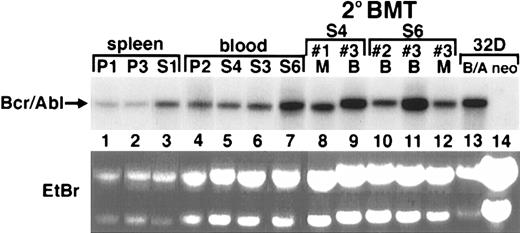 Fig. 6. Bcr/Abl mRNA and protein expression is readily detected in hematopoietic tissues from mice treated with STI571 or placebo, and in recipients of secondary BM transplants from STI571-treated animals. / Total RNA was prepared from placebo-treated (P) or STI571-treated (S) animals and analyzed by Northern blot by means of a P210BCR/ABL–specific probe. At right are total RNA samples of blood (B) or BM (M) from secondary BM transplant recipients (indicated by number) from the donor animals STI571 no. 4 (lanes 8,9) or STI571 no. 6 (lanes 10-12). As a control, total RNA from the myeloid cell line 32D transduced with either P210 (B/A) or retroviral vector alone (neo) is shown at far right (lanes 13,14). Ethidium bromide (EtBr)–stained total RNA samples from spleen and peripheral blood of the secondary BM transplant recipients are shown (lower panel) to demonstrate equal RNA loading among the groups of samples. The position of P210BCR/ABL mRNA is shown at the arrow.