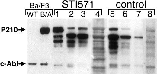 Fig. 7. Hematopoietic cells from some STI571-treated mice express increased levels of Bcr/Abl protein. / Protein lysates from blood and BM cells from either STI571-treated (left, lanes 1-4) or STI571-untreated (right, lanes 5-8) mice were analyzed by anti-Abl immunoblot. As a control, lysates from wild type (WT) Ba/F3 or a population of growth factor–independent Ba/F3 cells expressing P210BCR/ABL (B/A) are shown at left. The position of Bcr/Abl and endogenous c-Abl are shown at the arrows.