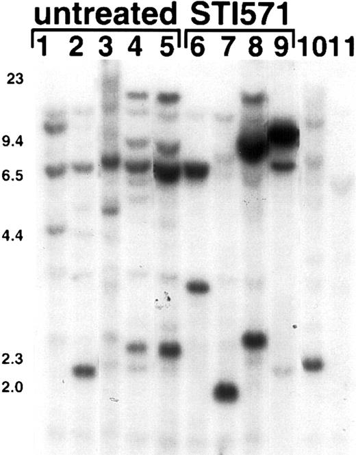 Fig. 8. A trend for oligoclonal leukemia in STI571-treated mice. / Genomic DNA was prepared from peripheral blood granulocytes from either STI571-treated (right, lanes 6-9) or STI571-untreated (left, lanes 1-5) mice, digested with the restriction enzyme BglII, and then analyzed by Southern blot by means of a neomycin probe. There is only a single BglII site within the proviral sequence recognized by the neomycin probe, with the second BglII site located in adjacent genomic DNA. Therefore, each leukemic clone will have a unique BglII fragment recognized by the probe.13 As controls, an oligoclonal lymphoid tumor cell line established from a mouse with the Bcr/Abl–induced ALL-like illness (lane 10) and BM cells from a syngeneic healthy mouse (lane 11) are shown at right.