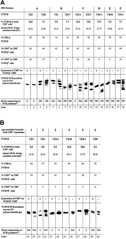Fig. 2. TCRVβ CDR3 length analysis. / The PCR products (approximately 220 base pairs) and molecular markers were run on a 6% polyacrylamide gel, and the sizes of the radioactive PCR bands were determined by exposing an x-ray film to the gel. Expanded T cells were sorted according to their specific surface phenotype of TCRVβ+ and CD8+ and CD57 expression. Bands are lined up side by side for ease of comparison. The relative position of the PCR products of different TCRVβ families to each other is not the same as the actual gel. *Expanded TCRVβ populations are underlined. (A) CDR3 length analysis results from CD8+ T-cell expansions found in 6 patients with MM, together with CD8 and CD57 expression data. (B) Results of 6 age-matched normal controls for comparison. **Direct DNA sequencing has been performed on some of the PCR products and results are summarized.