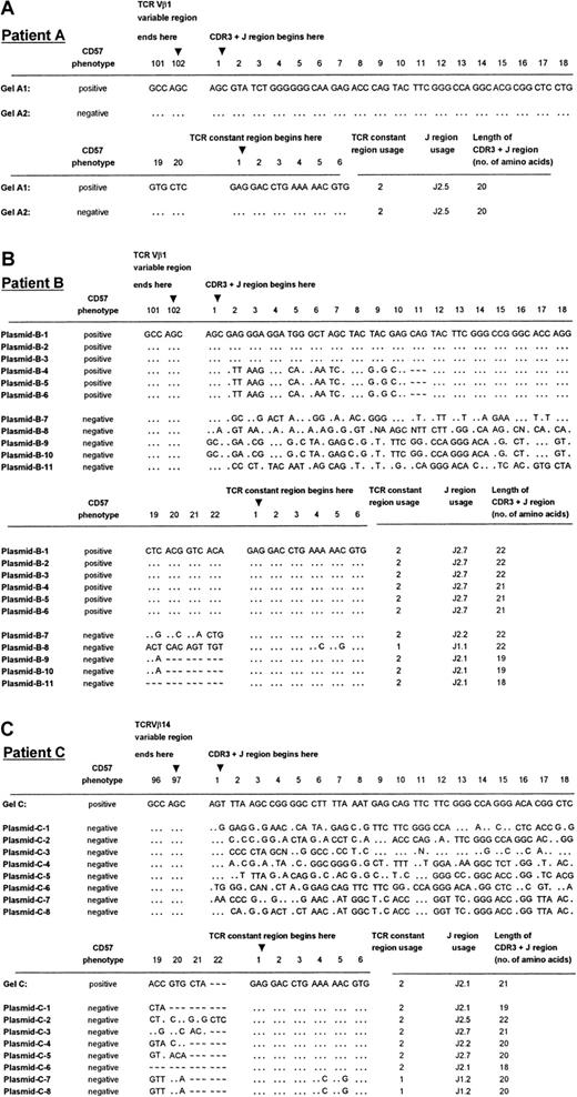 Fig. 3. TCRVβ DNA sequences of patients A through C. / Panels A, B, and C show the sequencing results of patients A, B, and C, respectively. DNA sequences were derived from direct sequencing of the CD57+ PCR products from patient A (labeled Gel-A1 in panel A) and patient C (labeled Gel-C in panel C). No readable sequence was obtained from direct sequencing of the CD57− PCR products, except in the case of patient A (labeled Gel-A2 in panel A). Plasmids B-1 to B-6 are 6 independent sequences obtained from 6 cDNA clones chosen at random from a library containing the CD57+ PCR product from patient B. Plasmids B-7 to B-11 are the independent sequences obtained from 5 cDNA clones from the CD57− PCR product from the patient shown in panel B. Plasmids C-1 to C-8 are 8 independent sequences obtained from 8 cDNA clones chosen at random from a library containing the CD57− PCR product from patient C (panel C). The sequences summarized in this Figure have been given the European Molecular Biology Laboratory (Heidelberg, Germany) nucleotide sequence database accession numbers: AJ276183 through AJ276184 for panel A, AJ276185 through AJ276195 for panel B, and AJ276196 throughAJ276204 for panel C. Keys: … identical nucleotides; ∼ ∼ ∼ absence of an amino acid at the relative position in the CDR3 sequence alignment.