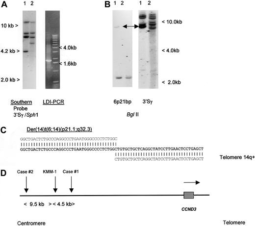 Fig. 1. Molecular cloning of illegitimate 3′ switch γ rearrangement from a case of CD5+ DLBCL. / (A) Left- hand panel: Southern blot using an IGH 3′Sγ probe. Tumor DNA (lane 1) showed a 3′Sγ rearranged fragment of 4.2 kb that did not comigrate with a 5′Sγ probe (data not shown). Lane 2 contained germline control DNA. The 4.2-kb-SphI rearranged fragment was amplified by LDI-PCR. Right-hand panel: The LDI-PCR target for IGH 3′Sγ yielded a 1.8-kb product that corresponded to the 4.2-kb fragment seen on Southern blot. The LDI-PCR product was subcloned and sequenced. (B) Left-hand panel: Southern blot of tumor and normal DNA digested with BglII and hybridized with chromosome 6p21 breakpoint probe, showing single rearrangement in the tumor DNA. Comigrating rearranged bands are shown with an arrow. Right-hand panel: Same filter rehybridized with IGH 3′Sγ, showing comigration of rearranged 6p21 and IGH sequences (arrows). (C) Sequence of the der(14)t(6;14)(p21;q32) breakpoint from case 1 (Accession No. AF388309). Bold letters denote breakpoint sequence; above, IGHSγ2 sequence (gi 1 066 109 gb U39 934.1 HSU39 934); and below, 6p21.1 BAC clone RP11-533O20, which contained both the breakpoint andCCND3. (D) Ideogram to show the localization of chromosome 6p21.1 breakpoints. All 3 cloned breakpoints fell 5′ (centromeric) of the cyclin D3/CCND3 gene, in regions containing repetitive DNA sequences. Within the BAC clone RP11-533O20, the breakpoints were located at nucleotides 79567 (case 1, AF388309), 84057 (myeloma cell line KMM-1, AF364073),29 and 93510 (case 2, AF388310). Horizontal arrow denotes transcriptional orientation ofCCND3.