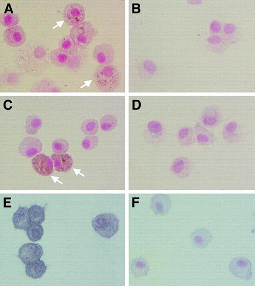 Fig. 5. AMs in Op/Op mice spontaneously express MMPs. / AMs from Op/Op mice showed positive staining for MMP-2 (A), MMP-9 (C) and MMP-12 (E). Some of the cells showed particularly dark intracytoplasmic staining for MMP-2 and MMP-9 (white arrows). In contrast, few cells from control mice showed positive staining for these enzymes (B,D,F) (× 450).