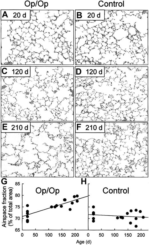 Fig. 7. Op/Op mice develop progressive, age-dependent pulmonary emphysema. / In the histologic evaluation, lungs of Op/Op and control mice of various ages were obtained and stained with hematoxylin and eosin. Representative photomicrographs of lung parenchyma are shown for Op/Op (A,C,E) and control mice (B,D,F) aged 20 days (A-B), 120 days (C-D). and 210 days (E-F). Progressive emphysema with enlarging air spaces occurred in lungs of Op/Op mice but not control mice (× 40). In the morphometric evaluation, digital images of lung tissues from Op/Op and control mice were captured during microscopy (above) and assessed by quantitative morphometry to determine the fractional area of airspace (airspace fraction). In young mice (n = 6/group; age, 20 ± 0 days), the corresponding values for airspace fraction were similar in Op/Op and control mice (P = .89; G,H). In marked contrast, in adult mice (n = 11/group; mean age, 165.3 ± 10.3 days in Op/Op mice and 161.5 ± 9.1 days in controls), the airspace fraction in Op/Op mice was increased significantly compared with that in littermate controls (P < .001). (G) The airspace fraction in adult Op/Op mice was also increased compared with that in young Op/Op mice (P < .0001). (H) In control mice, the airspace fraction did not change with age (P = .38). Linear regression defined the progressive increase in the airspace fraction as 3.6 ± 0.6 × 10−2 %/day in Op/Op mice (R = 0.82; slope significantly different from zero;P = .0001), whereas there was no significant change in controls (−5.4 ± 7.3 × 10−3 %/day; R = 0.18; slope not different from zero; P = .48).