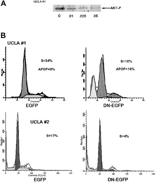 Fig. 2. Inhibition of AKT activity in MM cells curtails cell growth and S-phase distribution. / (A) UCLA no. 1 cells were treated with increasing concentrations of wortmannin (shown below protein bands in μM) for 2 hours and Western blot then performed with phosphospecific AKT antibody. Immunoblot for total AKT (not shown) showed no differences in expression of total AKT in all groups. Additional cells treated identically were cultured for 72 hours with the same concentrations of wortmannin and then viable cell recovery was recorded. Mean results of 4 independent experiments were used to determine LD50 as described. (B) UCLA no. 1 MM cells (top panels) and UCLA no. 2 cells (bottom panels) were transiently transfected with control EGFP vector (left panels) or EGFP vector expressing DN AKT (DN-EGFP, right panels). Twenty-four hours after transfection, cells were stained with Hoechst dye and cell cycle analysis performed by gating on EGFP+ cells. Percent of cells in S phase or apoptotic (APOP) is shown.