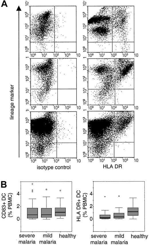 Fig. 1. Identification and distribution of peripheral blood DCs. / (A) PBMCs were gated and at least 50 000 events were acquired per sample. B cells, T cells, monocytes, and natural killer cells were detected with a cocktail of lineage-specific antibodies (lineage-marker) in FL-2. DCs were detected as lineage marker–negative cells with an isotype control antibody or anti–HLA-DR antibody in FL-1. Shown are examples of HLA-DR+ DCs in one healthy child (upper panel) and in 2 children suffering from severe malaria (middle and lower panels). (B) The boxplots indicate median and 25% and 75% percentiles for the percentage of CD83+ cells or HLA-DR+ DCs in healthy children and in children with severe or mild malaria. Outliers are indicated by open circles and extreme values are indicated by stars.