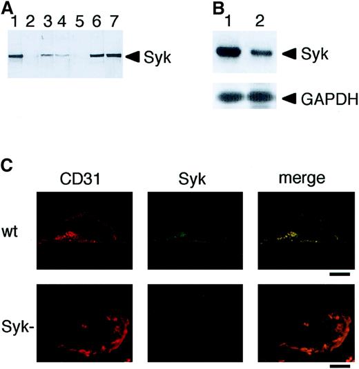 Fig. 1. Expression of Syk in vascular ECs. / (A) Immunoblot analysis of Syk in vascular ECs. Cell and tissue extracts (10 μg protein) were analyzed by immunoblotting with anti-Syk antibody: wild-type (lane 1) and Syk-deficient mice liver (lane 2), HUVECs (lane 3), BAECs (lane 4), Syk-deficient DT40 chicken B cells (lane 5), wild-type DT40 cells (lane 6), and human Ramos B cells (lane 7). (B) RT-PCR Northern blot analysis of Syk mRNA in Ramos B cell line (lane 1) and HUVECs (lane 2). The positions of Syk and glyceraldehyde-3-phosphate dehydrogenase (GAPDH) as control are indicated. (C) Expression of Syk in mouse embryonic ECs. Immunofluorescence microscopy of microvasculature of wild-type and Syk-deficient mice at embryonic day 18.5. ECs were double labeled with anti-Syk antibody and with anti-CD31 antibody as a marker for ECs. Bars = 1.0 μm