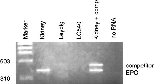 Fig. 2. Detection of Epo mRNA in rat Leydig cells and in LC-540 cell line. / The same RT-PCR experimental conditions were used. No Epo transcripts were detected in both cell types; no RNA (negative control), kidney (positive control).