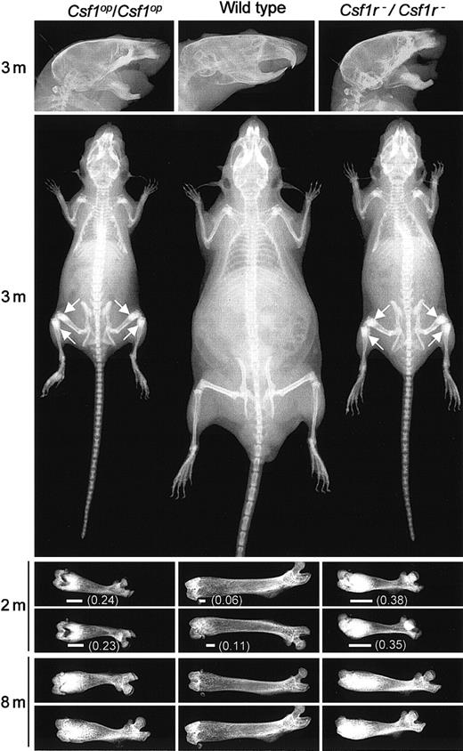 Fig. 2. Comparison of the skeletal development of wild-type,. / Csf1op/Csf1op, and Csf1r−/Csf1r−mice. Radiograms of the heads, bodies, and femurs of mice of the indicated genotypes at different ages (m, months). Each femur is from a different mouse. Arrows indicate regions of increased bone density most easily visualized at this magnification. Also shown is the extent (horizontal line) and fraction (in parenthesis) of the total femur length that is of high radiopacity.
