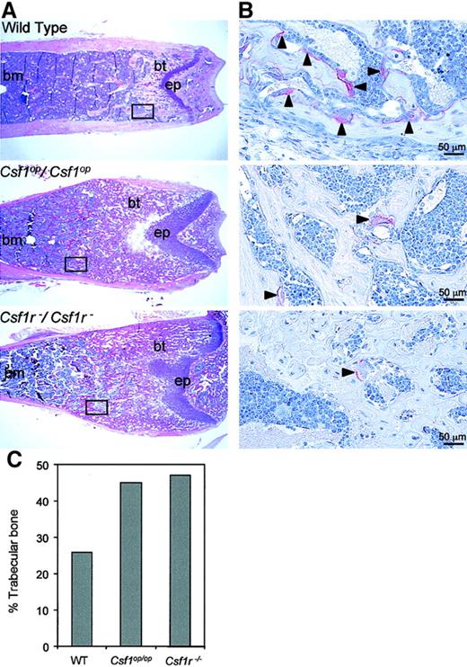 Fig. 3. Histology of bone marrow of wild type,. / Csf1op/Csf1op, and Csf1r−/Csf1r−mice. (A) Low-power photomicrographs of hematoxylin and eosin–stained midsagittal 5-μm sections of the distal femoral metaphyses of 8-week-old mice (bm, bone marrow; bt, bony trabeculae; ep, epiphyseal plate). Boxes indicate comparable areas of TRAP-stained sections photographed in B. (B) High-power photomicrographs of TRAP staining for osteoclasts in midsagittal 5-μm sections of femurs of 4-week-old mice in areas comparable to those boxed in A. Counterstained with hematoxylin. Arrowheads indicate TRAP+ cells. (C) Percentage of trabecular bone in the entire bone marrow cavity determined from the sections used in A. Original magnification A, × 25; B, × 400.A.