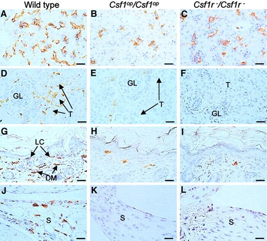 Fig. 5. F4/80+ cells in liver, kidney, skin, and synovial membrane. / Tissues from wild-type,Csf1op/Csf1op, andCsf1r−/Csf1r− mice were immunostained with a monoclonal antibody to F4/80 that selectively stains macrophages and were counterstained with hematoxylin. Sections of (A-C) 2-day-old livers, (D-E) 2-week-old kidneys showing macrophages surrounding the glomeruli (GL) and tubules (T) of wild-type mice (D), (F-I) 2-day-old skin showing immunostaining of both Langerhans cells (LC) and dermal macrophages (DM) from wild- type mice, and (J-L) longitudinal sections of 2-week-old knee joints in the region of the synovial membrane (S) showing immunostaining of cells in the wild-type synovial membranes. Note the more rounded and less dendritic appearance of the F4/80+ cells in the tissues of theCsf1op/Csf1op andCsf1r−/Csf1r− mice, previously reported forCsf1op/Csf1op mice. Bar, 50 μm. Original magnification A-L, × 400.