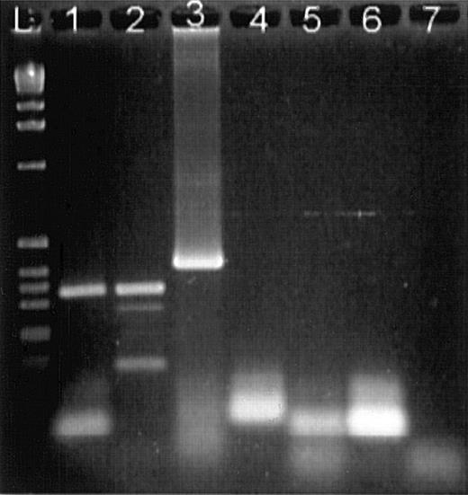 Fig. 10. Agarose gel electrophoresis of RT-PCR products stained with ethidium bromide. / (L) DNA ladder. (1) Bone marrow mononuclear cell mRNA with enolase primers showing an expected product of 329 bp. (2) mRNA from IL-2–activated NK cells with enolase primers. (3) Positive control of a 400-bp sequence of human SDF1a amplified with SDF1a primers. (4) mRNA from IL-2–activated NK cells with SDF1a primers showing an absence of SDF1a message. (5) Negative control, mRNA from IL-2–activated NK cells, reverse transcriptase was omitted. (6) Negative control, mRNA from activated NK cells was omitted. (7) Negative control, mRNA from activated NK cells, Taq polymerase omitted.