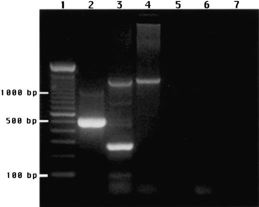 Fig. 12. Agarose gel electrophoresis of RT-PCR products stained with ethidium bromide. / (1) DNA ladder. (2) RT control. (3) Human liver mRNA. (4) mRNA from NK cells simulated with IL-2. (5) Negative control, NK mRNA, RT omitted. (6) Negative control, NK mRNA, Taq polymerase omitted. (7) Negative control, NK mRNA omitted. The 2 products seen with human liver mRNA correspond to a 1300-bp band derived from the transferrin receptor and a 270-bp band from TPO. NK mRNA gave a single product derived from the transferrin receptor but no TPO-derived product.