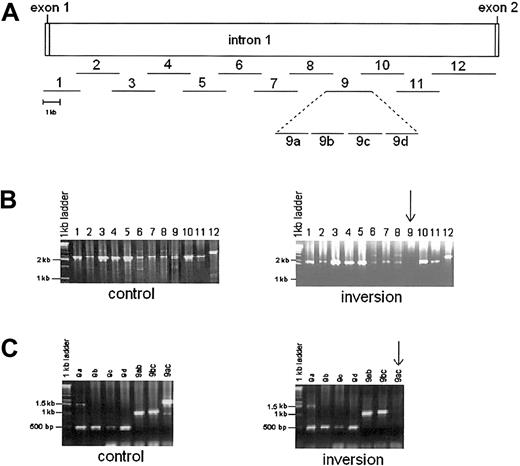 Fig. 2. PCR amplification of factor VIII intron 1 in control and intron 1 inversion patient (UKA 29). / (A) Amplification strategy. Lines with numbers show position and length of each segment amplified. Segment 9 has been expanded to show 4 adjacent reactions, 9a to 9d. (B). PCR products from control (left) and UKA29 (right) genomic DNA. Segment 9 consistently failed to amplify in UKA29 (arrow). (C) PCR amplification of sections of segment 9 in control (left) and UKA29 DNA (right). The 1.5 kb comprising sections a to c (9ac, arrow) could not be amplified from the DNA of UKA29. However, the 1-kb overlapping segments comprising sections a + b and b + c (9ab and 9bc) were amplified as readily as the individual sections 9a to 9d.