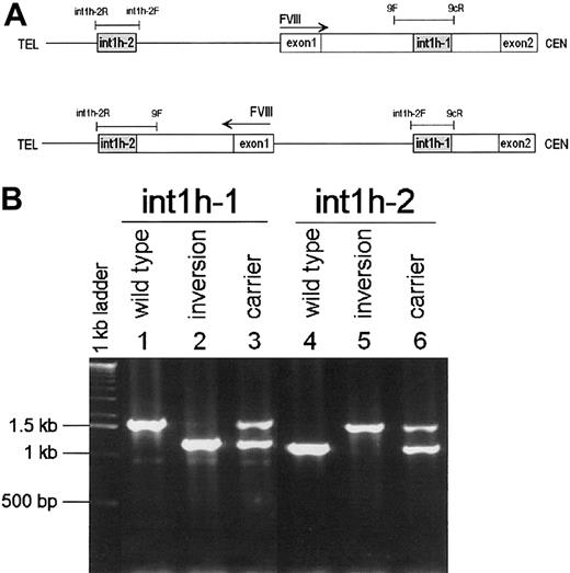 Fig. 6. PCR test for the FVIII. / int1h-related inversion. (A) Diagram of normal (top) and inversion (bottom) DNA showing the location and orientation of relevant sequences as well as PCR primers and reactions (thin bars). (B) Amplification of int1h-1 using 9cR, 9F, andint1h-2F primers (lanes 1, 2, and 3) and int1h-2using int1h-2F, int1h-2R, and 9F primers (lanes 4, 5, and 6). Control and inversion are males; carrier is female.
