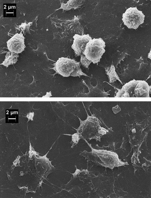 Fig. 5. Scanning electron microscopy of human PMNs adherent to HUVECs. / EC monolayers grown on a glass coverslip were pretreated for 4 hours with either iTCC (5 nM; top) or TNF-α (200 U/mL; bottom), and PMNs were added on top of the monolayers. After 30 minutes of incubation at 37°C, ECs were washed twice with PBS and then fixed with 2.5% glutaraldehyde in 0.2 M cacodylate buffer, pH 7.4.