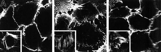 Fig. 10. Localization of PECAM-1 on HUVECs treated with iTCC. / HUVECs were grown to confluence on a glass coverslip and were incubated for 2 hours at 37°C with medium alone (A) or in the presence of either 200 U/mL TNF-α (B) or iTCC (5 nM) (C). Cells were then stained with anti–PECAM-1 (M89D3) mAb followed by FITC-GAM. Microscopic analysis was carried out in a Bio-Rad MRC 1000 confocal microscope (1 cm = 0.9 μm). Note the decrease of intercellular PECAM-1 staining in the TNF-α–treated HUVECs and the normal distribution of PECAM-1 in iTCC-treated HUVECs. Insets show fluorescence micrographs of F-actin distribution in HUVECs incubated with control medium (A), TNF-α (B), or iTCC (C).
